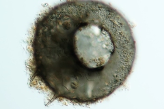 Centropyxis cf. discoides