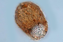 Difflugia sp.
