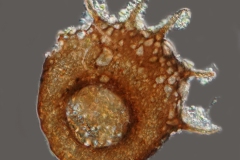 Centropyxis cf. aculeata