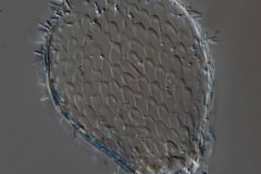 Euglypha ciliata