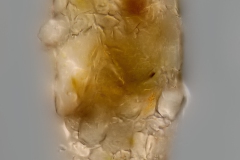 Difflugia cf. cylindrus