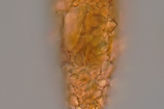 Difflugia cf. cylindrus