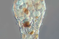 Difflugia cf. oblonga