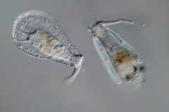 Nebela sp. und Difflugia sp.