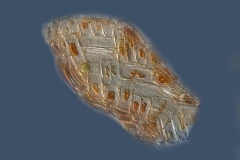 Difflugia sp.