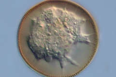 Arcella sp.