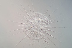 Actinophrys sol