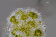 Raphidiophrys viridis (2)