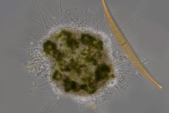 Raphidiophrys viridis (1)