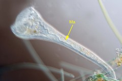 Stentor roeselii