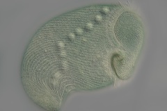 Stentor coeruleus