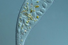 Stentor muelleri
