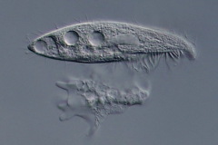 Blepharisma steini