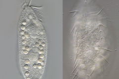 Holosticha sp.