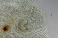 Stentor coeruleus