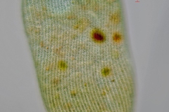 Stentor coeruleus
