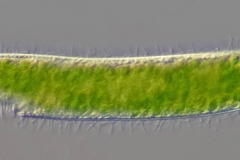 Pseudoblepharisma tenue var. viride