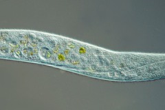 Spirostomum minus