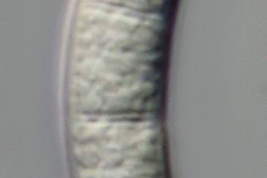 Pilzkonidie