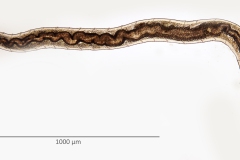 Chaetogaster sp. (1)
