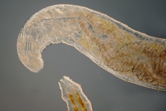 Chaetogaster sp. (2)