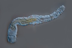 Aeolosoma sp.