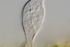 Salpingoeca amphora