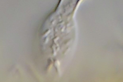 Salpingoeca amphora