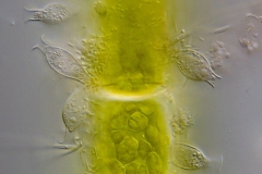 Salpingoeca amphora